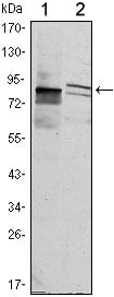 Mouse Monoclonal Antibody to KLHL11