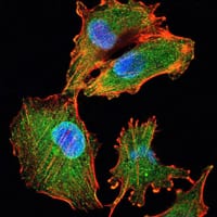 Mouse Monoclonal Antibody to IL34