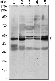 Mouse Monoclonal Antibody to SMAD3