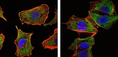 Mouse Monoclonal Antibody to CRTC1