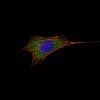 Mouse Monoclonal Antibody to BCL-2