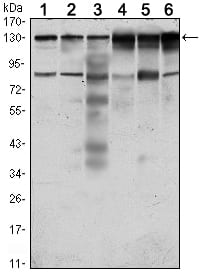 Mouse Monoclonal Antibody to PTK7