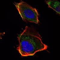 Mouse Monoclonal Antibody to HAS1