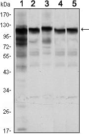 Mouse Monoclonal Antibody to HK1