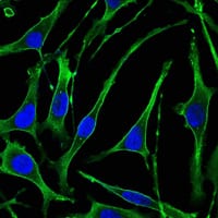 Mouse Monoclonal Antibody to PTH1R