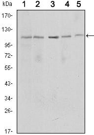 Mouse Monoclonal Antibody to SIRT1