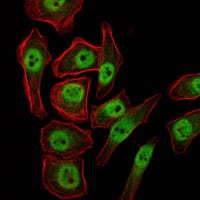 Mouse Monoclonal Antibody to KDM4A