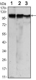 Mouse Monoclonal Antibody to HK2