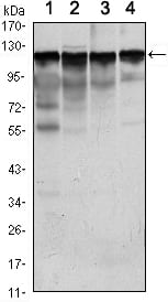 Mouse Monoclonal Antibody to HK1