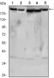Mouse Monoclonal Antibody to RICTOR