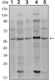 Mouse Monoclonal Antibody to SMAD4