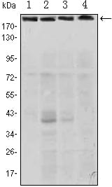 Mouse Monoclonal Antibody to RICTOR