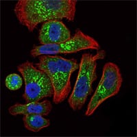 Mouse Monoclonal Antibody to EPO