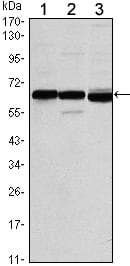 Mouse Monoclonal Antibody to ESR1
