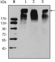 Mouse Monoclonal Antibody to KI67