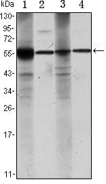 Mouse Monoclonal Antibody to ALDH1A1