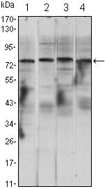 Mouse Monoclonal Antibody to CHUK
