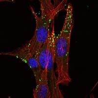 Mouse Monoclonal Antibody to KLHL1