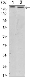 Mouse Monoclonal Antibody to ERBB2