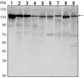 Mouse Monoclonal Antibody to CDH1