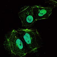 Mouse Monoclonal Antibody to TNFRSF11B