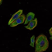 Mouse Monoclonal Antibody to SCGB2A2