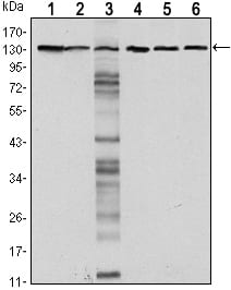 Mouse Monoclonal Antibody to CDH1
