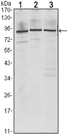 Mouse Monoclonal Antibody to IGF2BP3