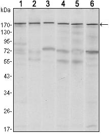Mouse Monoclonal Antibody to SETDB1