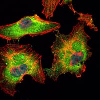Mouse Monoclonal Antibody to BLK