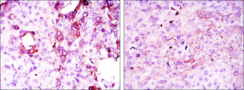 Mouse Monoclonal Antibody to TNFRSF11B