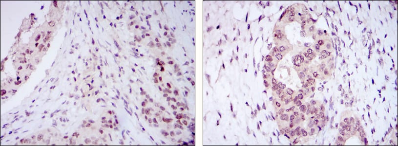 Mouse Monoclonal Antibody to NACC1