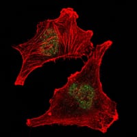Mouse Monoclonal Antibody to SUZ12
