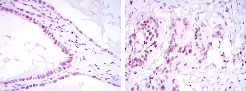 Mouse Monoclonal Antibody to SUZ12