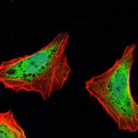 Mouse Monoclonal Antibody to ATXN1