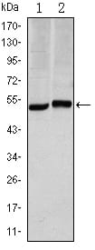 Mouse Monoclonal Antibody to CA9