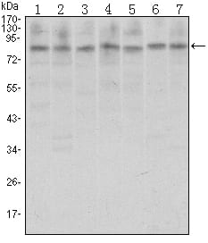 Mouse Monoclonal Antibody to CTCF