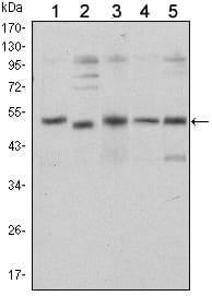 Mouse Monoclonal Antibody to SMAD5