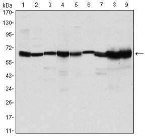 Mouse Monoclonal Antibody to CARM1