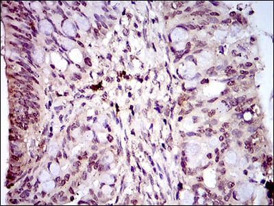 Mouse Monoclonal Antibody to PIWIL4