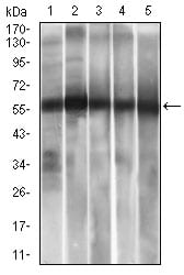 Mouse Monoclonal Antibody to ALDH2