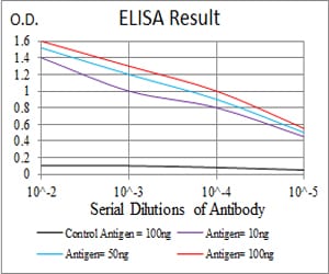 Mouse Monoclonal Antibody to LDLR