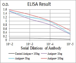 Mouse Monoclonal Antibody to LDLR