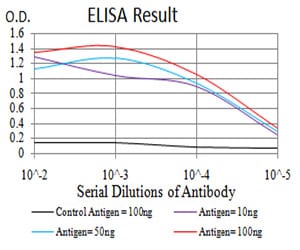 Mouse Monoclonal Antibody to CK5
