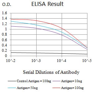 Mouse Monoclonal Antibody to ZAP70