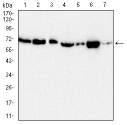 Mouse Monoclonal Antibody to ACHE