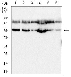 Mouse Monoclonal Antibody to ULK3