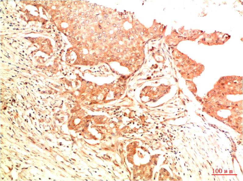 Mouse Monoclonal Antibody to Acetyl-p53 (Lys382)
