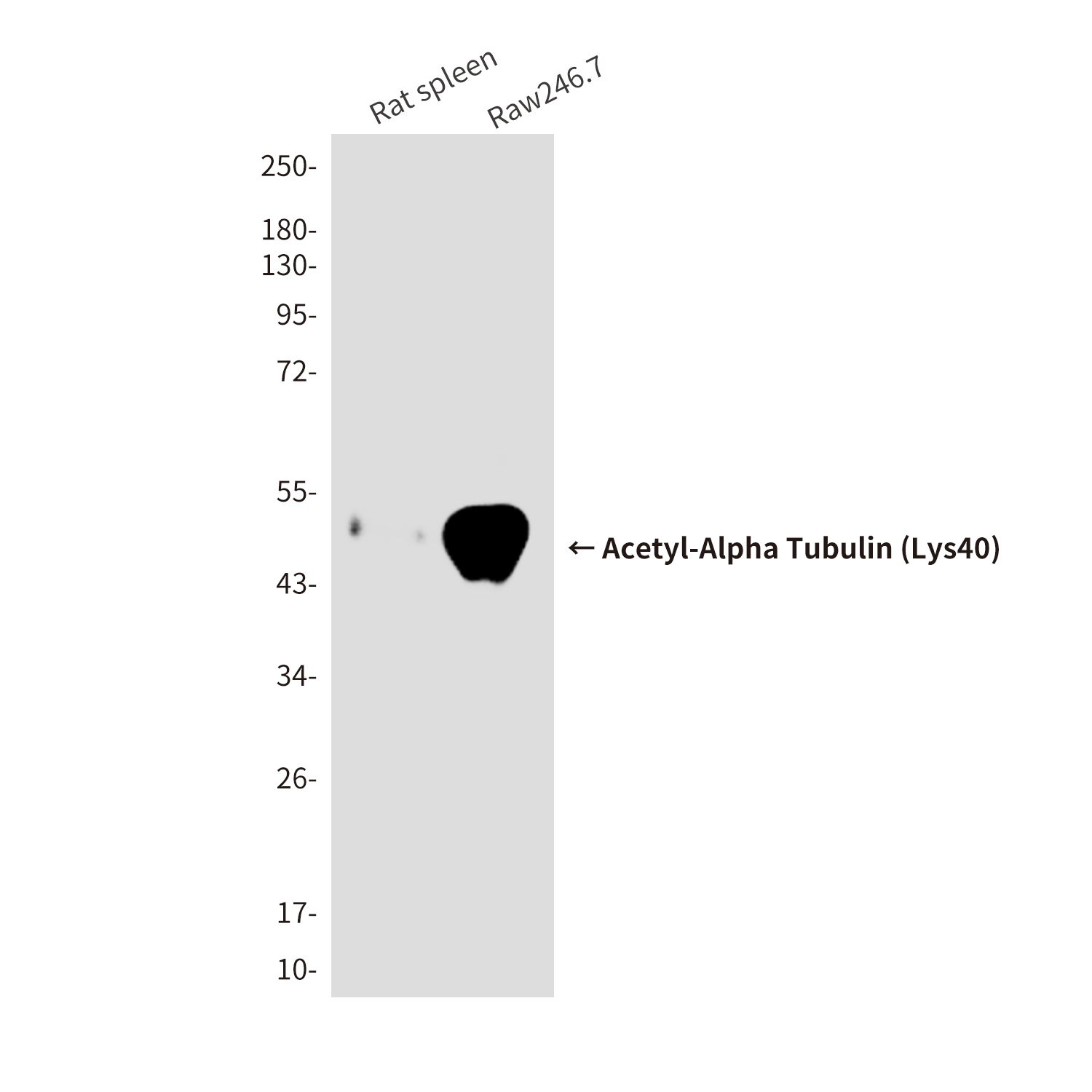 Mouse Monoclonal Antibody to Acetyl-Alpha Tubulin (Lys40)