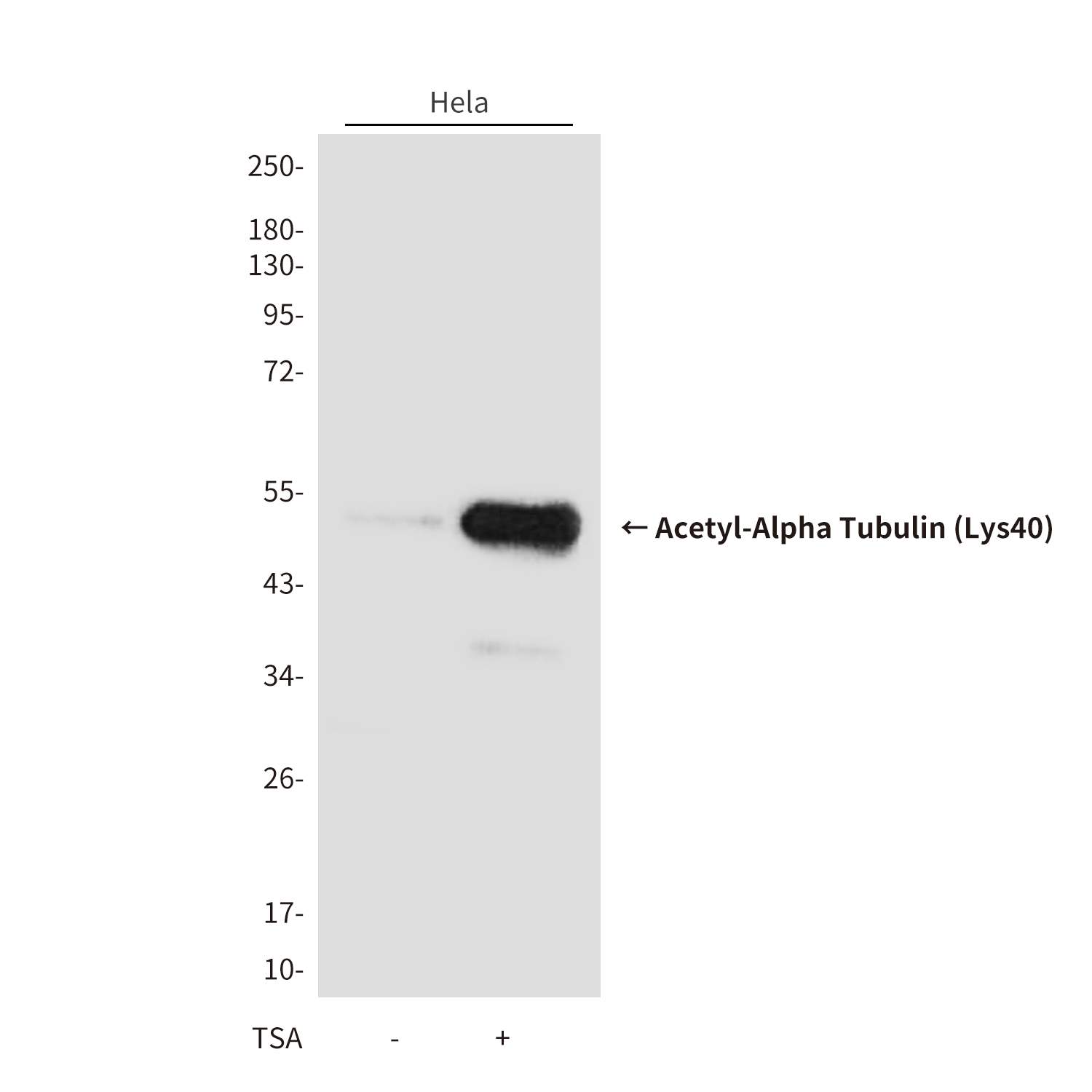 Mouse Monoclonal Antibody to Acetyl-Alpha Tubulin (Lys40)